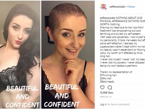 Body confidence activist Milly went viral after she candidly shared a post highlighting how deceptive photos can be by showing two different images of...